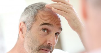 hair loss thinning aging baldness