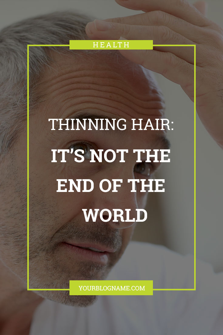 Yes, people can see your bald spot, but thinning hair isn't the end of the world. Here are 4 reasons why thinning hair shouldn't mean thinning hope.