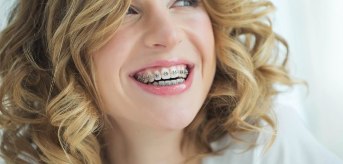 Young woman smiling in braces
